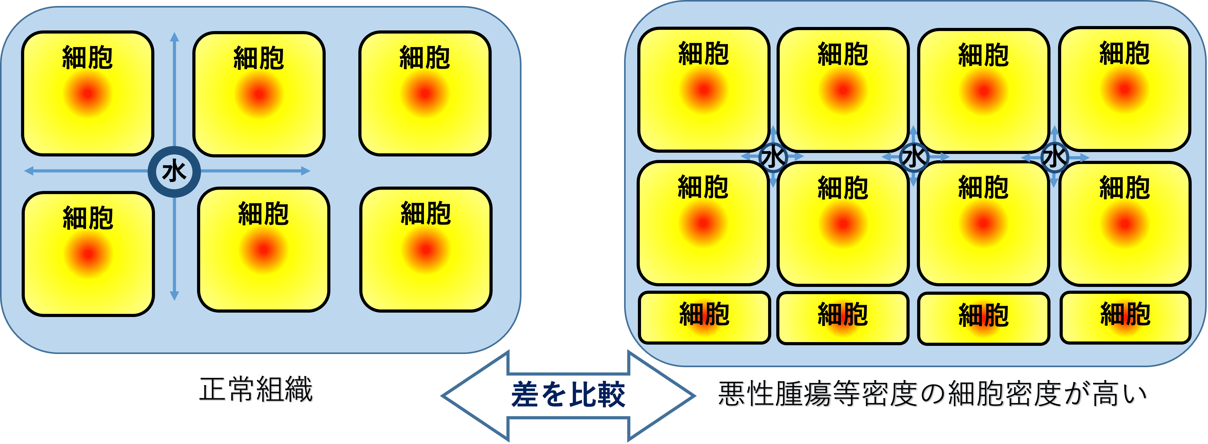 解説図 悪性腫瘍の細胞は正常組織より密度が高くなるので、差を比較することで検出することができます