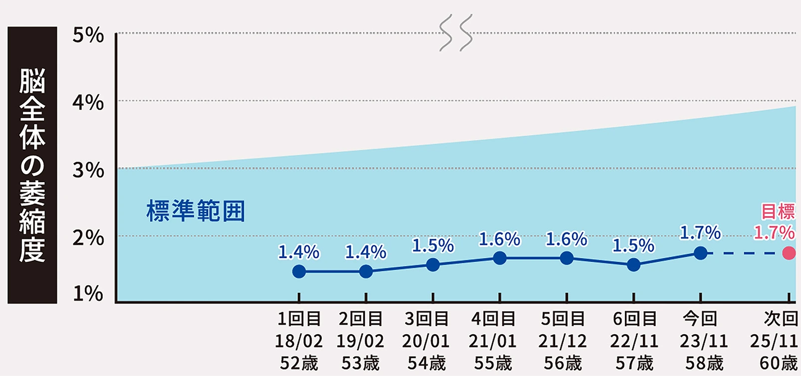 脳健康度AI解析は変化を数値化します