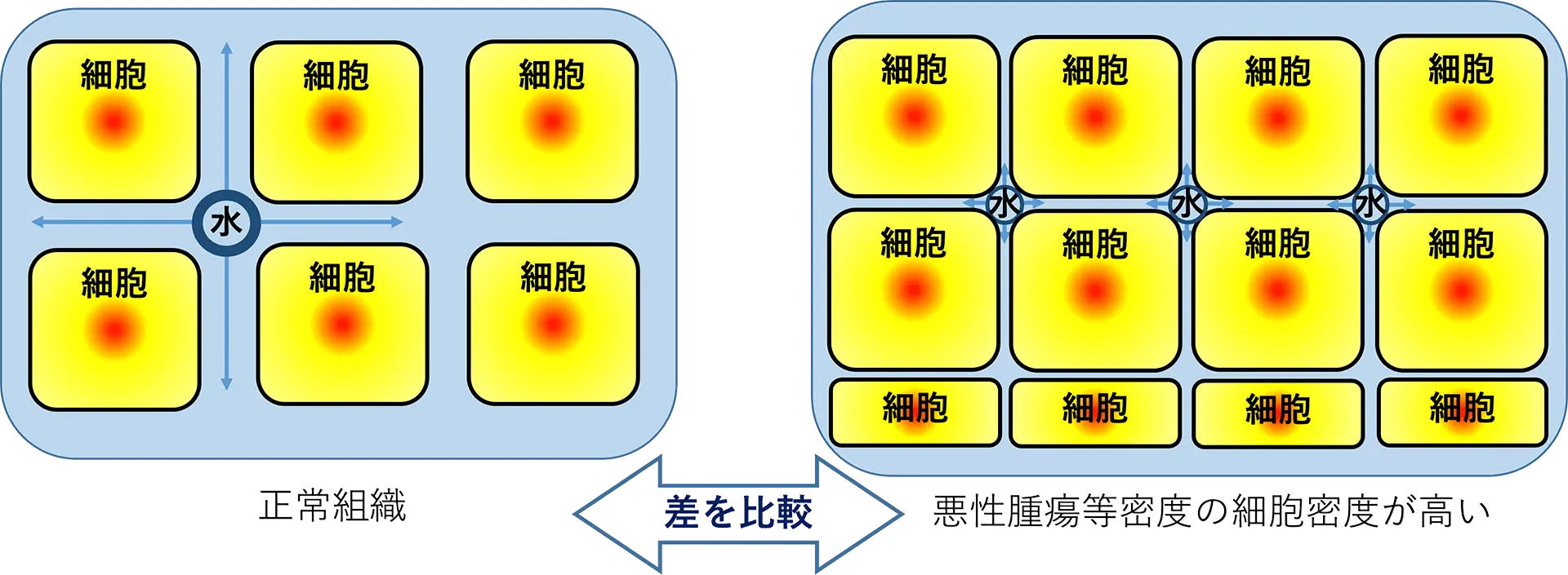 MRIで行なう全身がん検査「DWIBS」