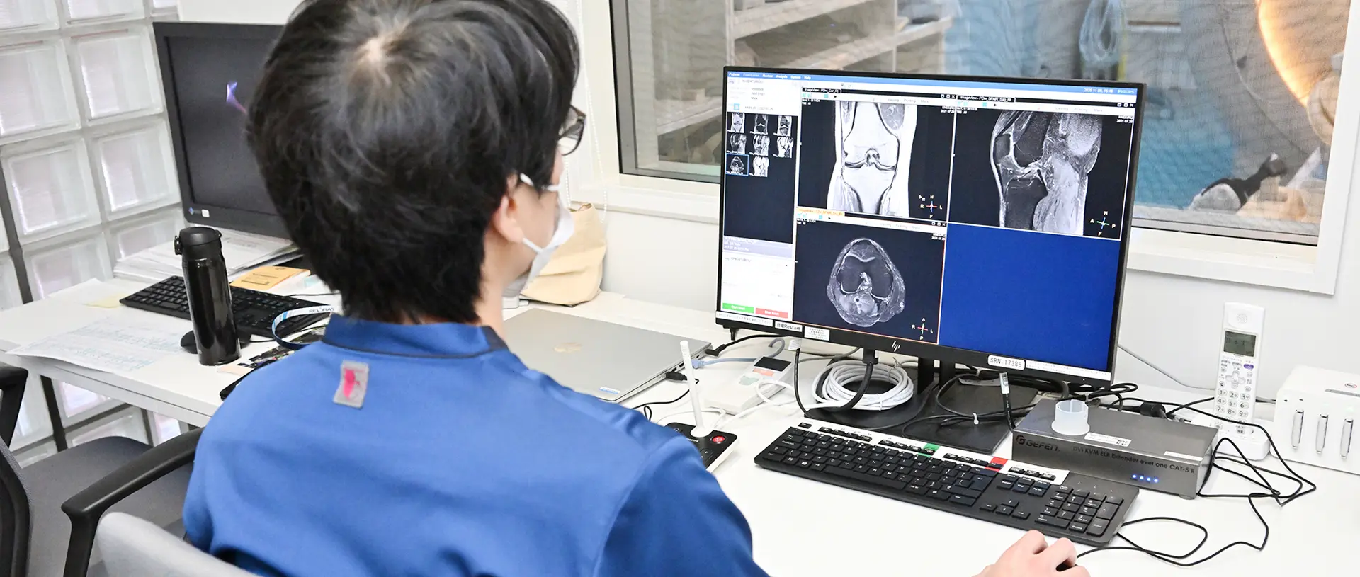 見えない病気を「見える」化する画像診断